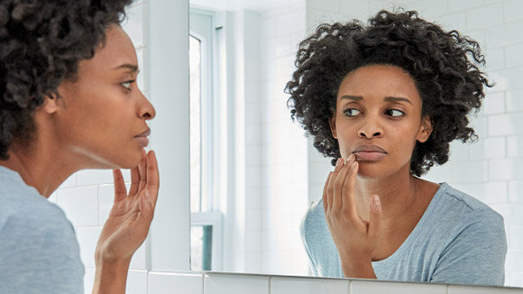 Une femme devant un miroir applique la crème Abreva